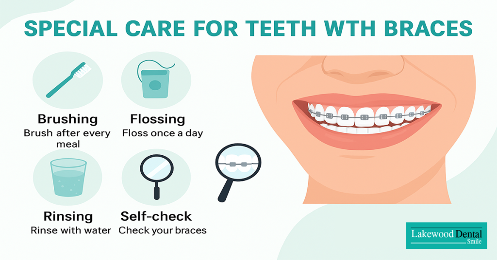 Special Care for Teeth with Braces