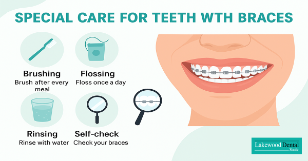 Special Care for Teeth with Braces