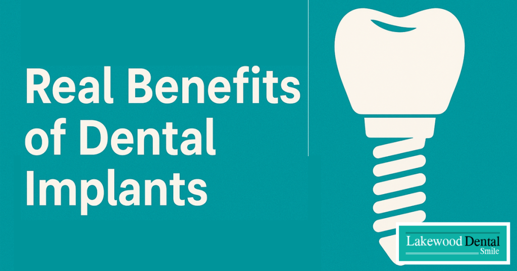 Benefits of Dental Implants
