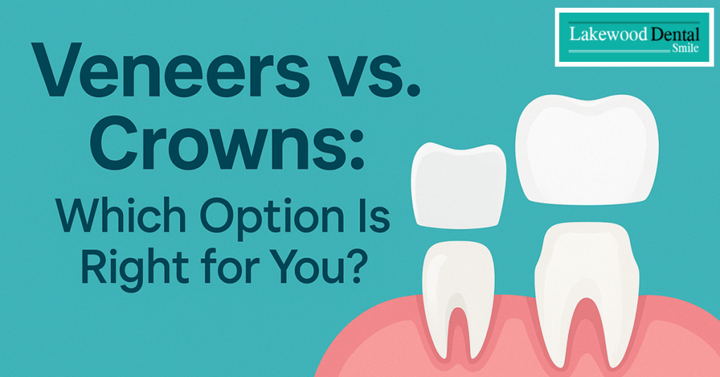 Veneers or Crowns