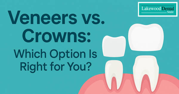 Veneers or Crowns