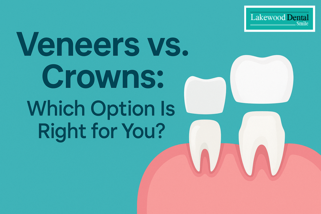 Veneers or Crowns