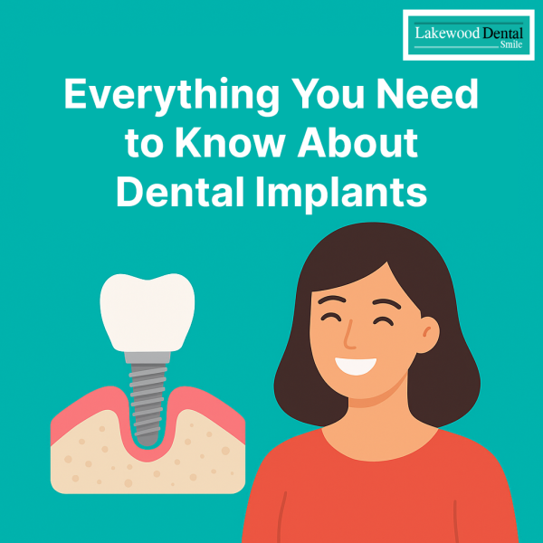 Everything You Need to Know About Dental Implants