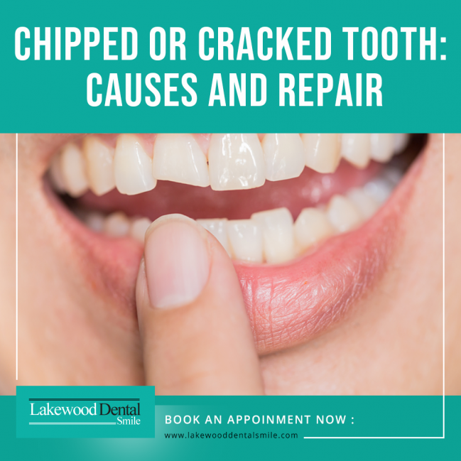 Chipped or Cracked Tooth Causes and Repair Lakewood Dental Smile