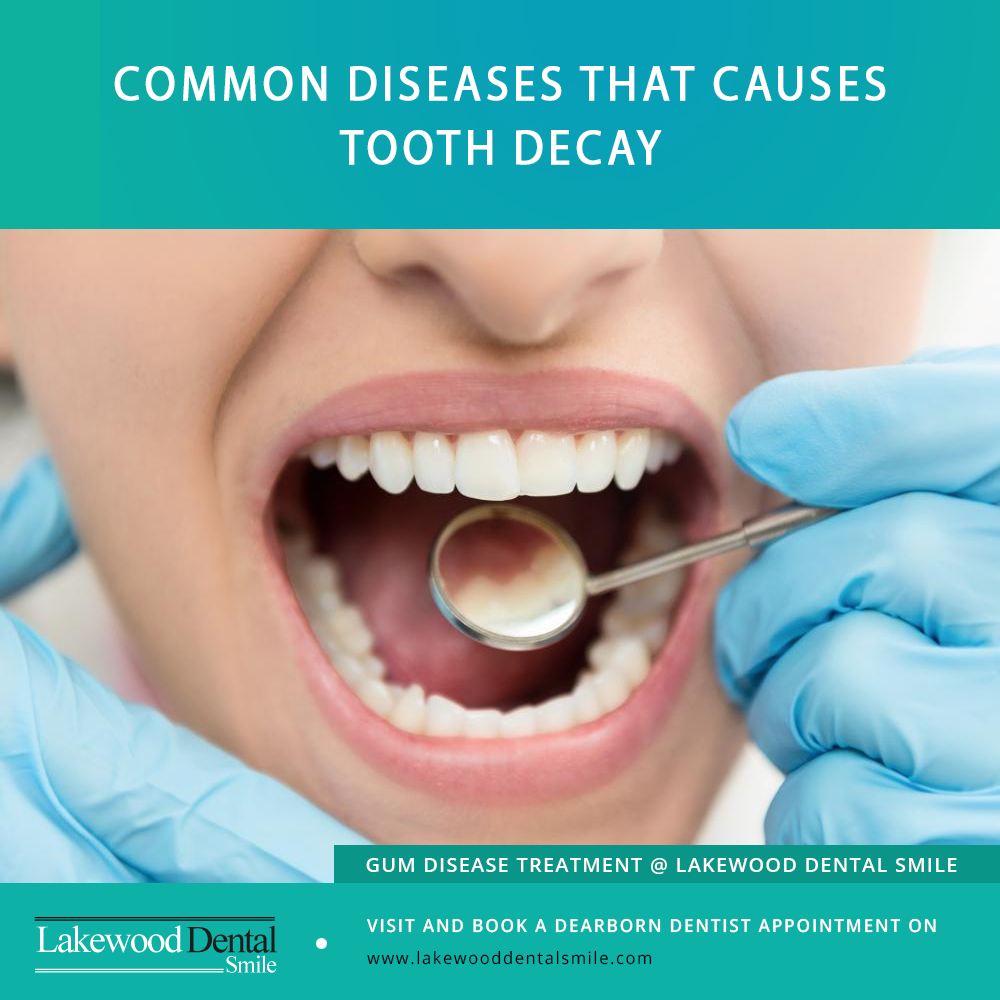 How certain diseases are linked to tooth decay