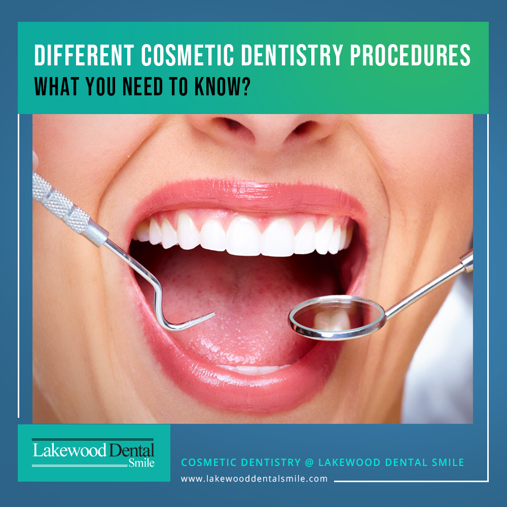 Different Cosmetic Dentistry Procedures– What you need to know?