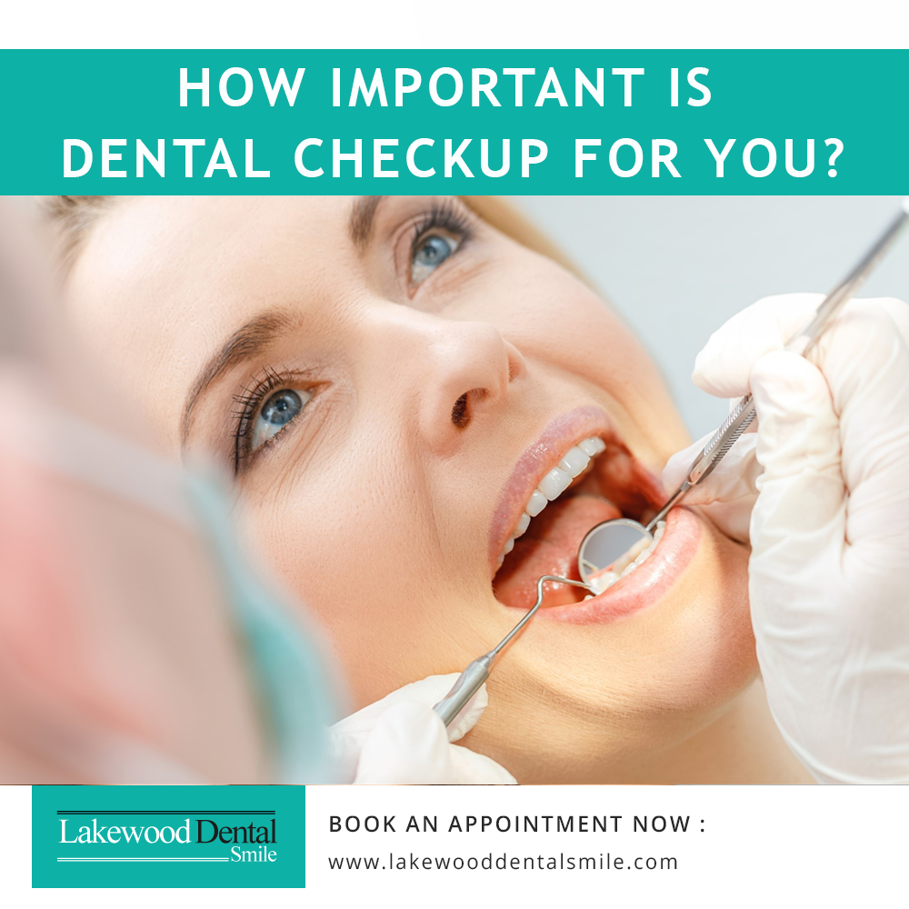How important is dental checkup for you?