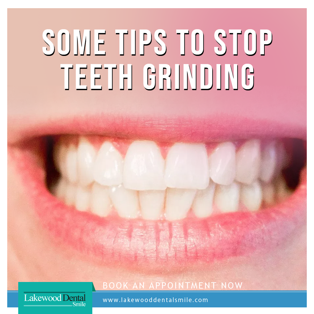 Ways to Prevent Grinding Your Teeth