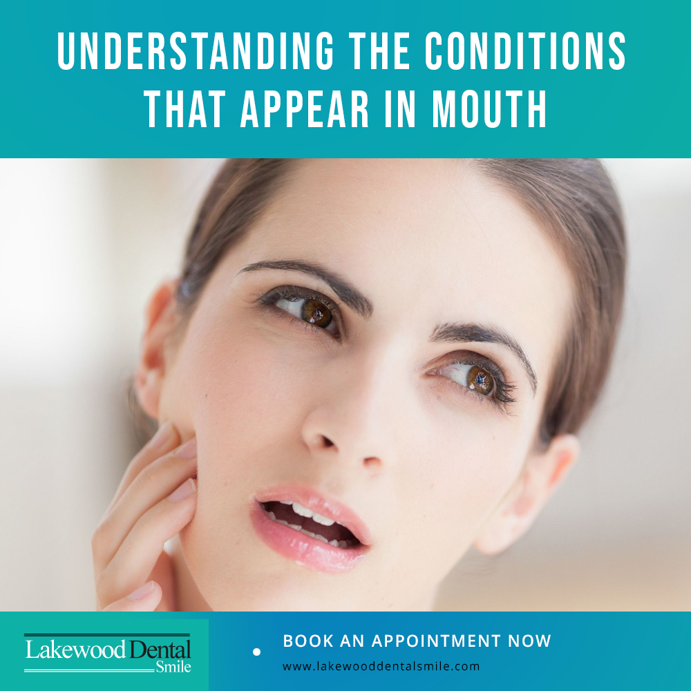 Understanding the conditions that appear in mouth