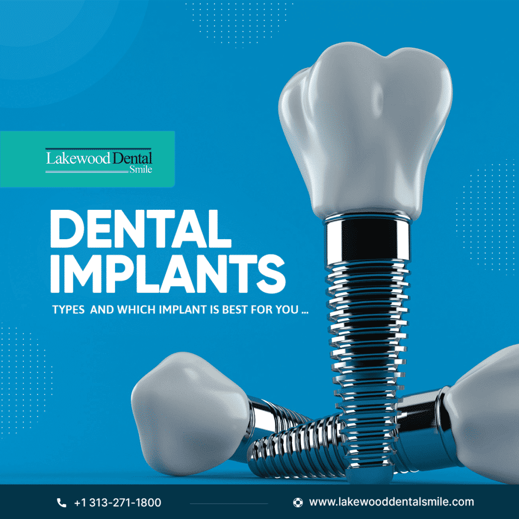 Types of Dental Implants