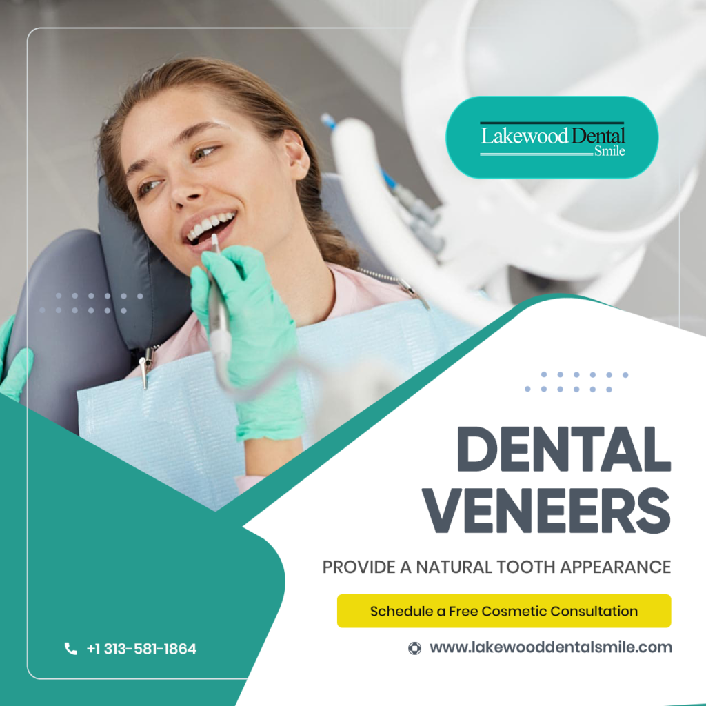 Dental_Veneers