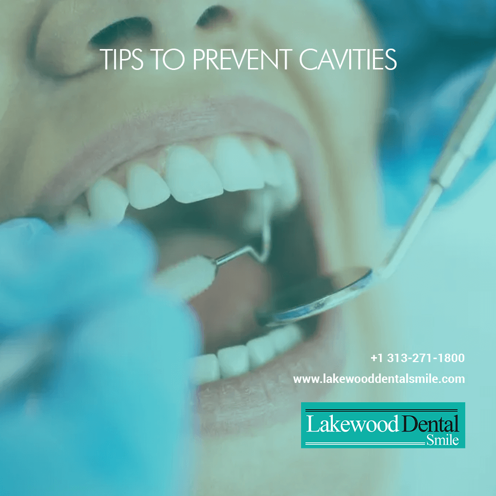 Tips to Prevent Cavities