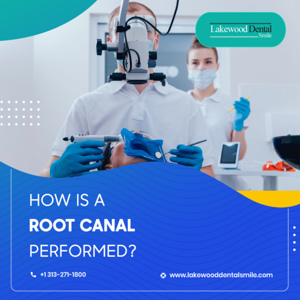 How is a Root Canal Performed