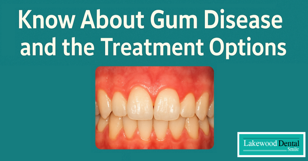 Gum disease treatment